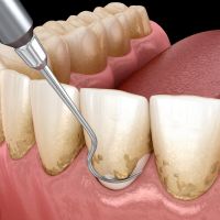 clinicas ortodoncia quito Clínica Odontológica Cabezas