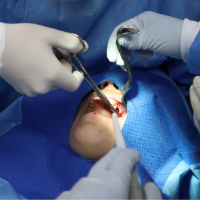 Cirugia dental Dr enrique