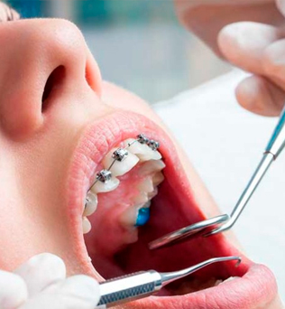 cursos estetica dental en quito Oral Beauty Clinica Dental